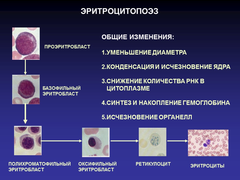 ЭРИТРОЦИТОПОЭЗ ПРОЭРИТРОБЛАСТ БАЗОФИЛЬНЫЙ ЭРИТРОБЛАСТ ПОЛИХРОМАТОФИЛЬНЫЙ ЭРИТРОБЛАСТ ОКСИФИЛЬНЫЙ ЭРИТРОБЛАСТ РЕТИКУЛОЦИТ ЭРИТРОЦИТЫ ОБЩИЕ ИЗМЕНЕНИЯ: 1.УМЕНЬШЕНИЕ ДИАМЕТРА